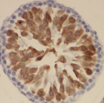 SSX4 Rabbit Polyclonal Antibody