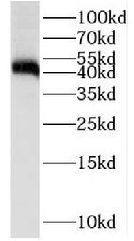 ST8SIA1 Rabbit Polyclonal Antibody