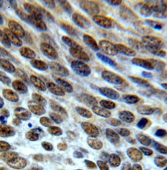 STAG2 Rabbit Polyclonal Antibody