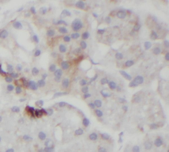 STARD5 Rabbit Polyclonal Antibody