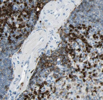 STAT6 Rabbit Polyclonal Antibody