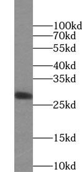 STC1 Rabbit Polyclonal Antibody