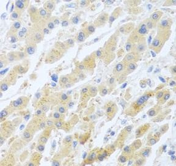 STC1 Rabbit Polyclonal Antibody