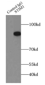 STIM1 Antibody