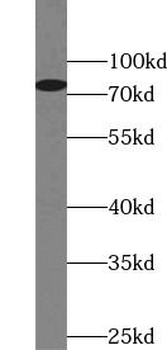 STIM1 Mouse Monoclonal Antibody