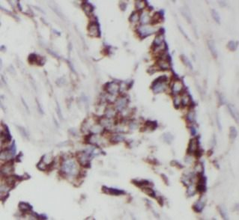 STIM1 Mouse Monoclonal Antibody