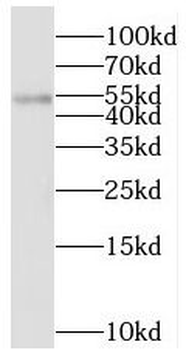 STK24 Rabbit Polyclonal Antibody