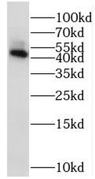 STK32B Rabbit Polyclonal Antibody