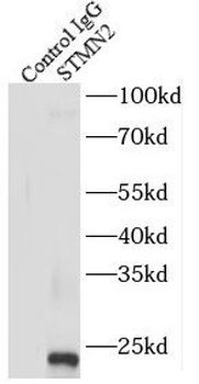 STMN2 Antibody