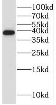 STRADB Rabbit Polyclonal Antibody