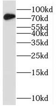 STRBP Rabbit Polyclonal Antibody