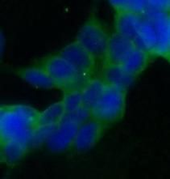 STT3A Rabbit Polyclonal Antibody