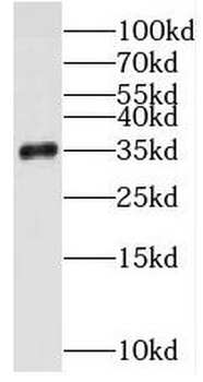 STUB1 Antibody