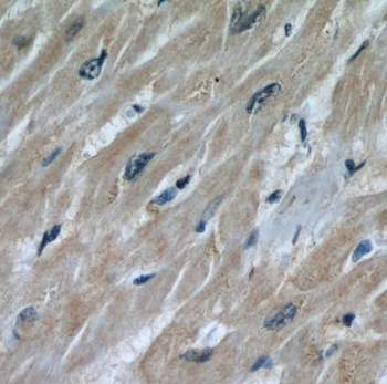 STUB1 Antibody
