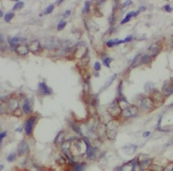 STXBP2 Rabbit Polyclonal Antibody