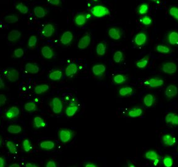 SUB1 Rabbit Polyclonal Antibody