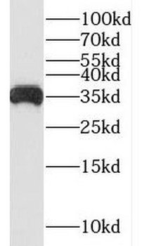 SUCLG1 Rabbit Polyclonal Antibody