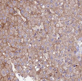 SUCLG1 Rabbit Polyclonal Antibody