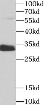 SULT1A1 Rabbit Polyclonal Antibody