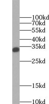 SULT2A1 Antibody