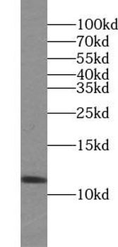 SUMO2/3 Antibody