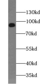 SUN1 Rabbit Polyclonal Antibody