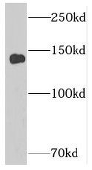SUPT16H Rabbit Polyclonal Antibody