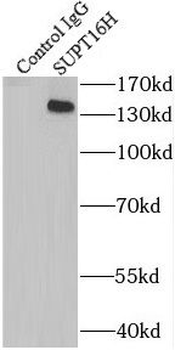 SUPT16H Rabbit Polyclonal Antibody