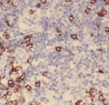 SUPT16H Rabbit Polyclonal Antibody