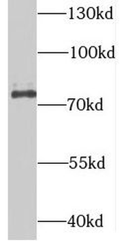 SUPV3L1 Rabbit Polyclonal Antibody