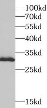 SURF1 Rabbit Polyclonal Antibody