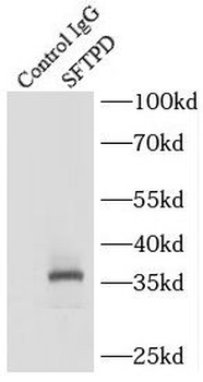 SFTPD Rabbit Polyclonal Antibody