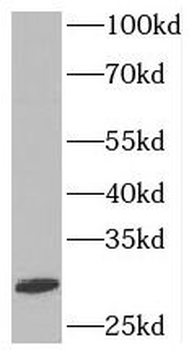 SYF2 Rabbit Polyclonal Antibody