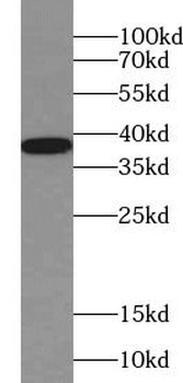 SYP Antibody