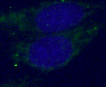 SYT1 Rabbit Polyclonal Antibody