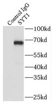 SYT1 Rabbit Polyclonal Antibody