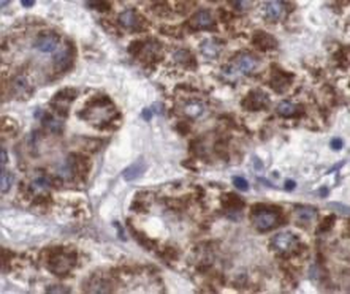 SYT1 Rabbit Polyclonal Antibody