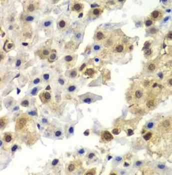 SYNCRIP Rabbit Polyclonal Antibody