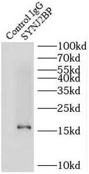 SYNJ2BP Rabbit Polyclonal Antibody