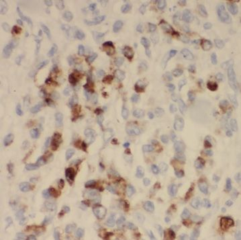 SYNJ2BP Rabbit Polyclonal Antibody