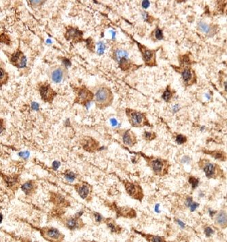 STX6 Rabbit Polyclonal Antibody