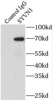 SYVN1 Antibody