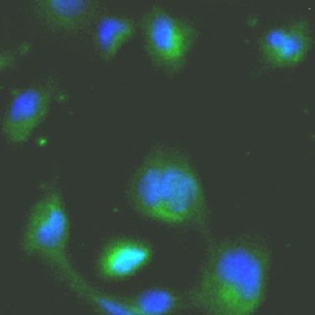 TAB1 Rabbit Polyclonal Antibody