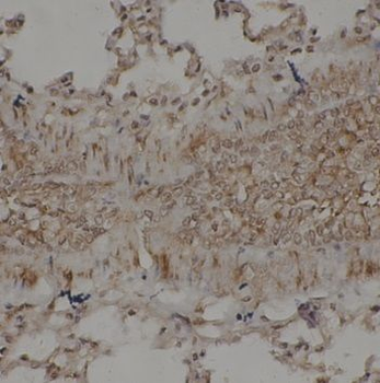 TAB1 Rabbit Polyclonal Antibody