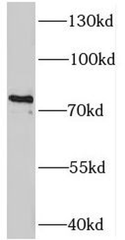 TAB2 Antibody