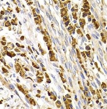 TACR3 Antibody