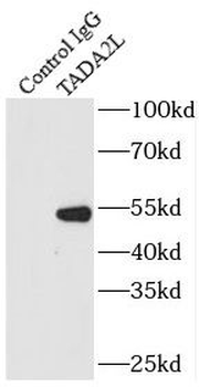 TADA2A Antibody