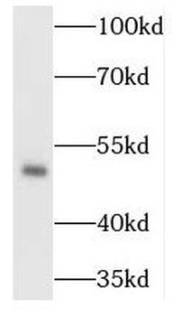 TADA3 Rabbit Polyclonal Antibody