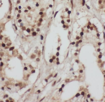 TADA3 Rabbit Polyclonal Antibody