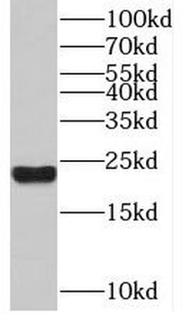 TAF12 Rabbit Polyclonal Antibody